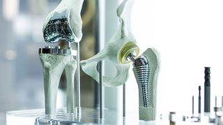 Was als Medizinprodukt gilt und was nicht, ist genau geregelt. (Hier: Knie- und Hüftprothese) (© Monstar Studio - stock.adobe.com)