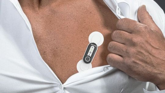 Artemis: EKG Chip zur Echtzeiterkennung von Vorhofflimmern(Bild:  Fraunhofer IMS)