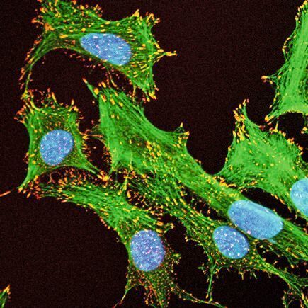 Bei der in vitro-Dosimetrie wird ein komplexes Bild der Nanopartikel-Wirkungen in Zellkulturen ermittelt. (Empa)