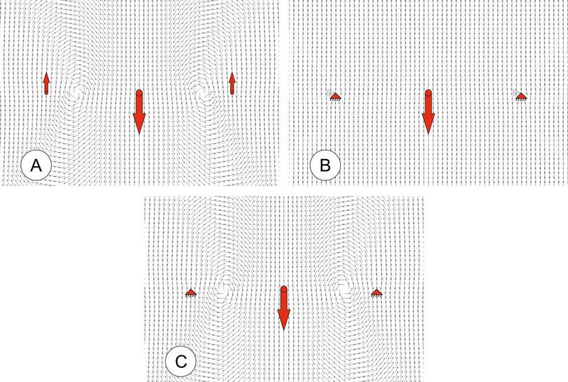 Abb. 2: Die Filtertechnik nach Reuter [2] zum Nachweis überschriebener Wirbel erlaubt es, die in Abb. 1 bzw. 2A sichtbaren Wirbel auch bei deren Überschreibung durch eine dominante 