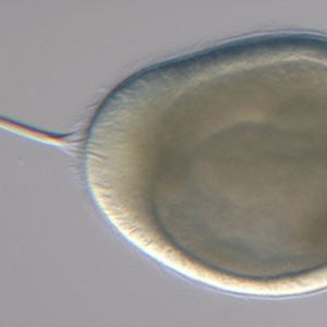 Abb. 2: Das Bild zeigt eine Larve von Planula (4 Tage alt), das Apikalorgan ist besonders gut zu sehen.