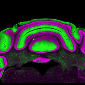 Hirnaktivität bei Bewegungsstörungen

Eine Studie der Virginia-Tech-Neurowissenschaftlerin Meike van der Heijden vom Fralin Biomedical Research Institute stellt eine weit verbreitete Annahme in der Erforschung neurologischer Bewegungsstörungen infrage. Oft konzentrieren sich Neurowissenschaftler auf die Aktivität zweier Zelltypen: Purkinje-Zellen im Kleinhirn und Zellen in den tiefen Kleinhirnkernen. Bisher gingen Forschende davon aus, dass die Aktivität der Purkinje-Zellen zuverlässig Rückschlüsse auf die Aktivität der tiefer liegenden Kernzellen erlaubt – da Purkinje-Zellen deren Aktivität hemmen.

Van der Heijdens Studie widerlegt diese Annahme. „Wir sehen, dass es keine klare lineare Beziehung zwischen der Aktivität der Purkinje-Zellen und der der tiefen Kernzellen gibt. Die Vorhersagekraft der einen für die andere ist daher sehr begrenzt“, sagt die Neurowissenschaftlerin.

Das Bild zeigt: Purkinje-Zellen im Kleinhirn (grün) und Zellen der tiefen Kleinhirnkerne (dunkle Bereiche mit grünen Einsprengseln in der Bildmitte). 

Hier geht‘s zur Originalmeldung
Wissenschaftsbild des Tages vom 2.7.2026
 (Bild: Meike van der Heijden/Virginia Tech)