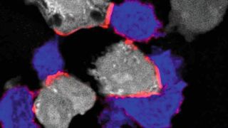 Immunfluoreszenzmikroskopie: T-Zellen (blau) greifen Krebszellen (grau) an, indem sie über ihr Oberflächenprotein LFA-1 an sie binden. LFA-1 braucht Magnesium, um eine aktive, langgestreckte Form einzunehmen (aktives LFA-1 in rot).  (J. Lötscher et al., Cell, 2022)