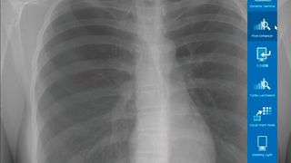 Die Utility Software beschleunigt den Zugriff auf Funktionen im QA Medivisor Agent. (Bild: JVCKENWOOD)