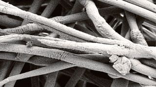 Abb.1: Rasterelektronenmikroskopische Aufnahme einer mit Zinkoxid ausgestatteten Wundauflage  (Innovent e.V.)