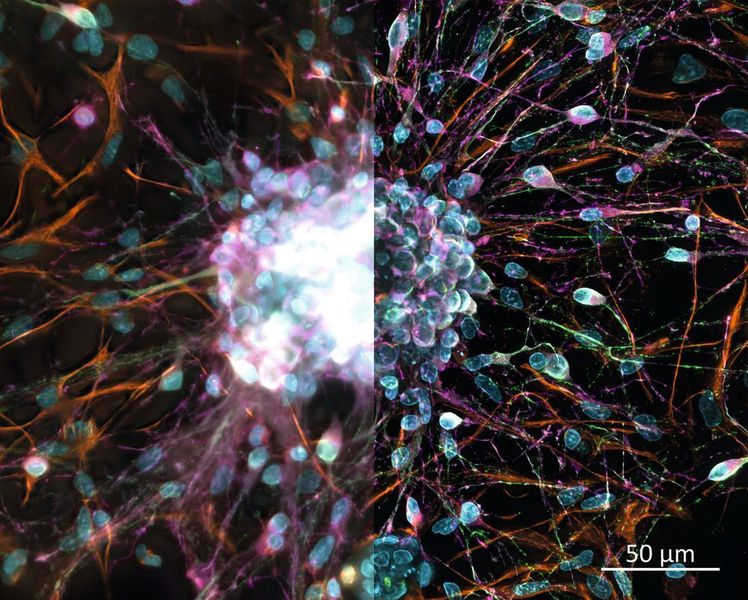 Abb. 3: Z-Stapel-Projektion vor (links) und nach (rechts) GPU-basierter Dekonvolution, aufgenommen mit den Autocorr-Objektiven von Zeiss Celldiscoverer 7. Probe: Primärkulturen von Rattenkortex (Mit freundlicher Genehmigung von H. Braun, LSM Bioanalytik GmbH, Magdeburg)