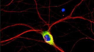 Das HDAC6 Protein (grün) reguliert den Transport von Mitochondrien – den Kraftwerken der Zellen – entlang von "Mikrotubuli-Straßen" (rot) in Nervenzellen (Kern blau dargestellt). Dieser Prozess ist in Alzheimer-Nervenzellen inhibiert und kann durch Ausschalten von HDAC6 normalisiert werden. (Bild: André Fischer)