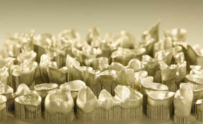 Bild 3: Der große Vorteil der Titanlegierung Rematitan ist, dass eine hohe Materialdichte erreicht werden kann. So hergestellte Dentalprothesen widerstehen höheren mechanischen Belastungen als konventionelle Gießteile. (Bild: Concept Laser)