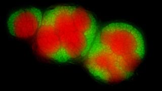 Archaeen (rot) und Bakterien (grün) bilden ein Konsortium zur Methanoxidation. Die Proben stammen aus Tiefseesedimenten vor der Küste Kaliforniens, Monterey Bay nach Fluoreszenz-in-situ-Hybridisierung (CARD-FISH). (Quelle: Annelie Pernthaler/UFZ) (Archiv: Vogel Business Media)