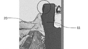 Dentalimplantat (Bild: Zircon Medical IP Box AG/DPMA)