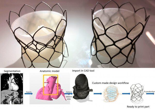 3D Medlab aus Frankreich gewann mit einem maßgeschneiderten Aortaklappen-Ventil in der Kategorie Medtech.  (3D Medlab)