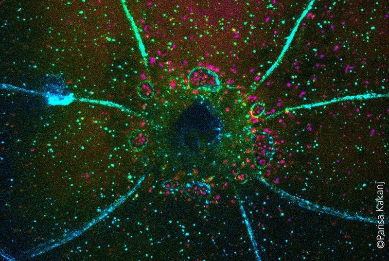 Wundheilung schweißt Zellen zusammen  Nach einer Verletzung startet der Körper sein Reparaturprogramm: Das Immunsystem ist in besonderer Alarmbereitschaft, Blutplättchen stoppen die Blutung und die Hautzellen beginnen schließlich damit, über die folgenden Tage die Wunde wieder langsam zu schließen. Nun haben Forscher Der Universität Köln gezeigt, dass mehrere Einzelzellen bei der Wundheilung verschmelzen. Der Grund hierfür ist wohl das Recyclingprogramm von Zellen, die so genannte Authophagie. In anderen Studien z. B. über die Entwicklung von Muskeln, führt diese Verschmelzung von Einzelzellen zu mechanischer Stabilität, bietet eine starke Barrierefunktion zum Schutz des Gewebes vor Krankheitserregern und die Fähigkeit größere Krankheitserreger oder Zellabfall zu verdauen. Ob der Prozess bei der Wundheilung ähnliche Funktionen erfüllt, ist noch nicht klar.  Das Bild zeigt das Schließen einer Wunde in einer Drosophila-Larve. Membranen und autophagische Bläschen sind blau gefärbt.   Hier gehts zur Originalmeldung Wissenschaftsbild des Tages vom 15.3.2022 (Parisa Kakanj)
