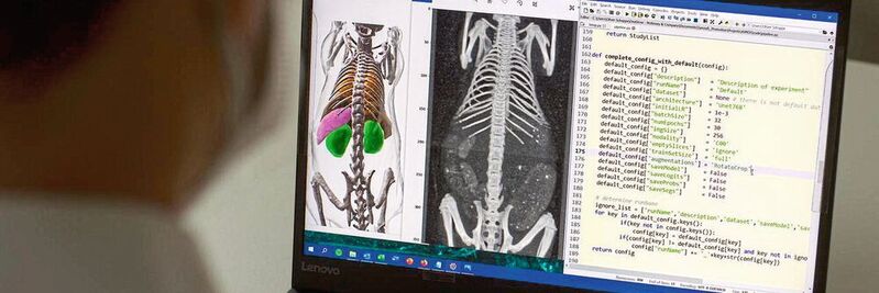 Dank Künstlicher Intelligenz ist die AIMOS-Software in der Lage, auf dreidimensionalen Graustufenbildern Knochen und Organe zu segmentieren, was die anschließende Auswertung erheblich erleichtert.