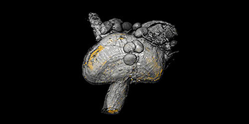 3D-Modell des Proventrikulus, eines speziellen Organs der Tsetsefliege: Die Verteilung der Trypanosomen ist anhand der fluoreszierenden Zellkerne in Gelb visualisiert. (Lehrstuhl Zoologie I/eLife)