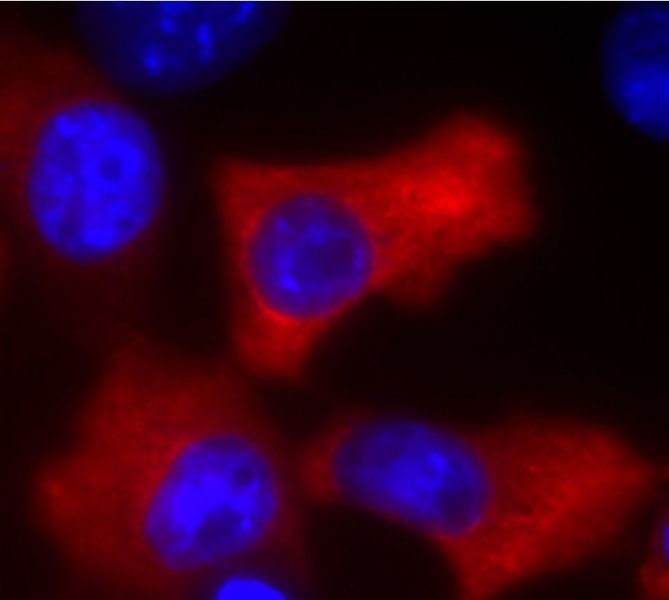 Das Bild zeigt eine Immunfluoreszenz-Aufnahme von TSC22D4 (rot) exprimierenden Zellen. (Helmholtz Zentrum München)