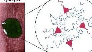 Amerikanische Wissenschaftler haben einen neuartigen Gel-Wundverschluss entwickelt, der sich chemisch wieder auflösen und so schonend entfernen lässt. (Bild: (c) Wiley-VCH)