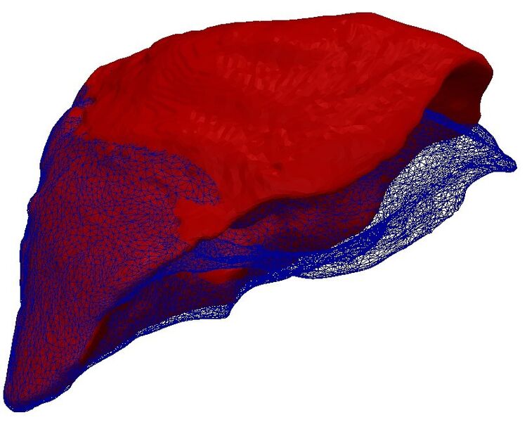 Das unverformte Lebermodell (rot) passt sich an das verformte Oberflächenprofil(blau) an. (Grafik: Dr. Stefanie Speidel, KIT, in Medical Physics, 41)