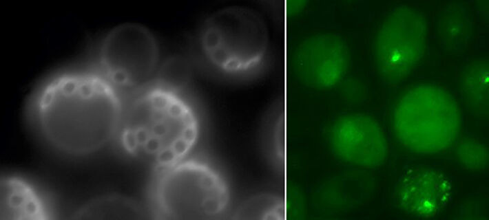 The age of the yeast can be determined by counting the bud scars (left). As the cells age, you can examine how proteins aggregate (light spots in the image to the right). (Mikael Molin)