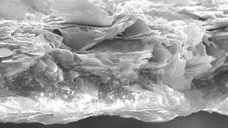 REM-Aufnahme einer Zinklamellenbeschichtung mit einer Schichtdicke von 20 µm. (Dörken MKS)