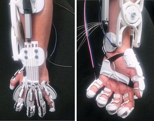 An der Universität Stuttgart wurde ein Hand-Exoskelett entwickelt, mit welchem die Greif-Fähigkeit einer gelähmten Hand wiederhergestellt werden kann. An der Universität Stuttgart wurde ein Hand-Exoskelett entwickelt, mit welchem die Greif-Fähigkeit einer gelähmten Hand wiederhergestellt werden kann.
