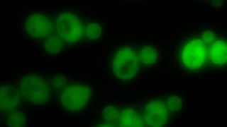 Hefezellen ohne Proteinaggregate (Gruppe Matthias Peter / ETH Zürich)