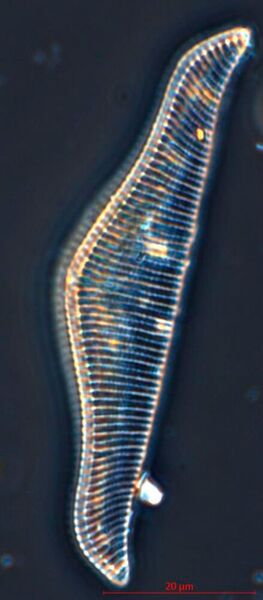 There are thousands of different diatom species in the Baltic Sea, and each one of those species can be identified due to their unique siliceous structures. (Rhopalodia gibba) (Leena Virta)