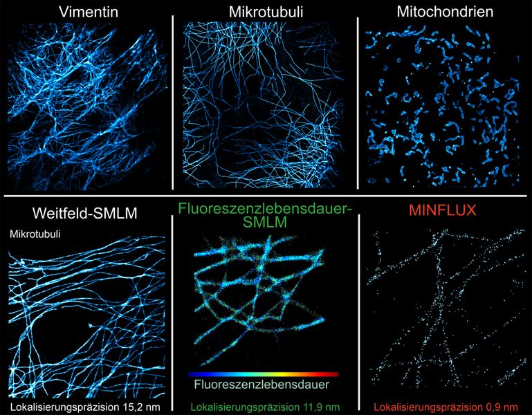 Blinkende Mikroskopie    Wie lassen sich einzelne Moleküle in Zellen möglichst präzise abbilden? Eine wichtige Rolle spielen dabei Nanokörper: winzige Fragmente von Antikörpern, die spezifisch an Moleküle binden. Um diese sichtbar zu machen, werden sie mit bestimmten Farbstoffen markiert. Bisherige Farbstoffe funktionieren jedoch oft unzuverlässig. Ein internationales Forschungsteam unter Leitung der Universität und der Universitätsmedizin Göttingen (UMG) hat einen Weg gefunden, dieses Problem zu umgehen: Die Forschenden nutzten „selbstblinkende“ Farbstoffe, die eigenständig zwischen einem hellen und einem dunklen Zustand wechseln können.  Das Team zeigte, dass der Ansatz bei verschiedenen Verfahren der Superauflösungsmikroskopie einsetzbar ist – darunter bei einigen der präzisesten derzeit verfügbaren Methoden in der Fluoreszenzmikroskopie.  Im Bild: Selbstblinkender Farbstoff, der in verschiedenen zellulären Strukturen und Bildgebungsverfahren eingesetzt wird. Obere Reihe (v.l.): Superauflösungsbilder von Vimentin – einem Protein des Zellskeletts –, Mikrotubuli und Mitochondrien mithilfe von selbstblinkenden Farbstoffen. Untere Reihe (v.l.): Mit Weitfeld-SMLM, Fluoreszenzlebensdauer-SMLM und MINFLUX abgebildete Mikrotubuli, die zeigen, dass dieselbe selbstblinkende Markierungsmethode mit verschiedenen Verfahren der Superauflösungsmikroskopie kompatibel ist.   Hier geht‘s zur Originalmeldung Wissenschaftsbild des Tages vom 29.10.2026  (Bild: Adaptiert von Originalveröffentlichung in Nano Letters (2026); DOI: 10.1021/acs.nanolett.6c02799)