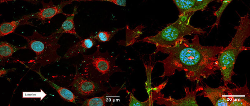 Links: Zellen ohne antibakterielle Ausrüstung; rechts: Zellen mit antibakterieller Ausrüstung  (Bild: Förch, MPI-P)