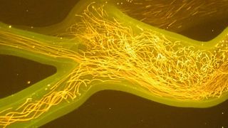 Die Bewegung der Tracer-Partikel, beleuchtet vom Licht des Spectra-Physics-Millennia-Lasers und aufgenommen mit einem Orangefilter. (Bild: Hi-D Imaging)
