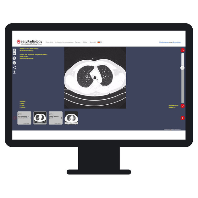 Easy Radiology – Abschied von der Patienten-CD