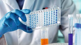 Ein Ergebnis des aktuellen EY-Biotechreport: der Sondereffekt durch Corona ist vorbei (Symbolbild).  (Bild: angellodeco - stock.adobe.com)