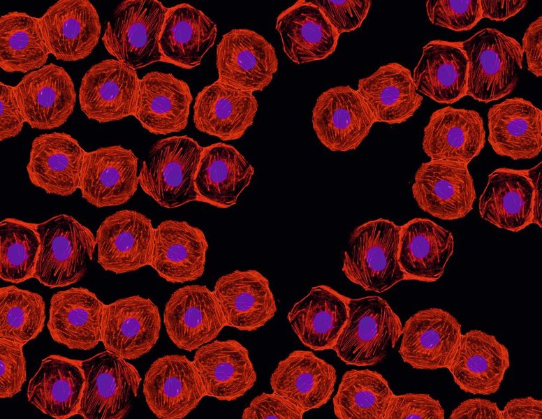 Abb.3: Fluorezenzmikroskopie ist ein wichtiges Tool, z. B. für die Biomedizin. Die Aufnahmen erfordern hochauflösende Kameras. (Bild: ©Ellen - stock.adobe.com)