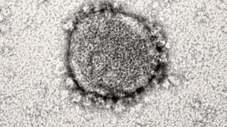 Das neue Coronavirus steht im Zentrum zahlreicher Forschungsprojekte des Ulmer Instituts für Molekulare Virologie. Jetzt haben die Forschenden einen vielversprechenden zelleigenen und antiviralen Faktor charakterisiert (Bild: Dr. Clarissa Read/Uni Ulm)