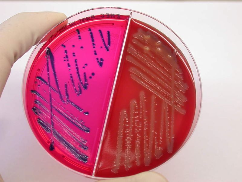 Exakte Labordiagnostik spielt im neu gegründeten CIDC (Zentrum für Infektionskrankheiten) eine wichtige Rolle.  (Bild: Anzüchtung von Erregern auf Spezialnährböden, UK Ulm)