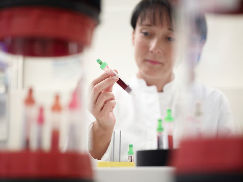 Abb. 2: Die präanalytische Phase umfasst alle Vorgänge vor der eigentlichen Analyse bis zum Abschluss der Probenvorbereitung. (Bild: Roche)