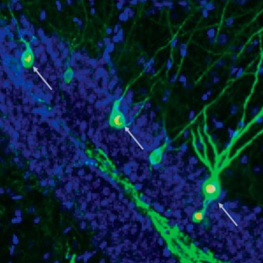 The new study shows that boosting neurogenesis increases the number of newly formed neurons involved in storing and retrieving memories (arrows) in the hippocampus of mice with AD. The new study shows that boosting neurogenesis increases the number of newly formed neurons involved in storing and retrieving memories (arrows) in the hippocampus of mice with AD.