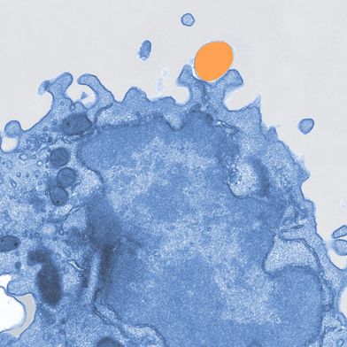 Pseudokoloriertes Elektronenmikroskopiebild einer Makrophage (blau), die Mikroplastik (orange) aufnimmt. (Bild: Mass Lab/Uni Bonn)