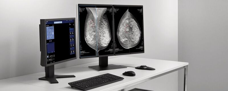 Siemens Healthineers nutzt im Rahmen seines MRT-Portfolios KI-Algorithmen, z. B. die Befundungslösung Syngo.Breast Care beim Mammographie-Screening.
