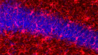 Gefräßige Mikrogliazellen (in rot) ... (Ausschnitt)  ( © TU Braunschweig/Martin Korte)