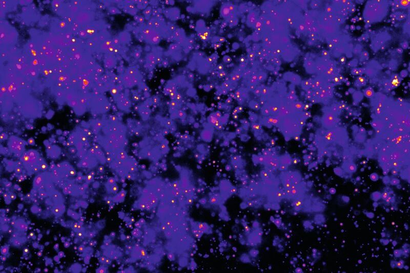 Fluoreszenzmikroskopisches Bild von hydrolysierbaren Öltröpfchen, die in ein Hydrogel eingebettet sind.