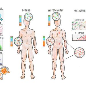 ((c) Holly McKelvey/Exzellenzcluster „Inflammation at Interfaces“)