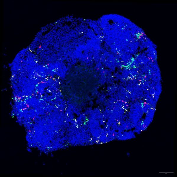 Organoid der Großhirnrinde   Seit fast 15 Jahren entwickeln Forscher dreidimensionale biologische Mikrostrukturen, so genannte Organoide – von Herzmodellen über Darmmodelle bis zu Gehirnmodellen. Mit ihnen lassen sich bestimmte Fragestellungen zur Organentwicklung in einem isolierten System untersuchen. Die Hippenmeyer-Gruppe am Institute of Science and Technology Austria (ISTA) hat nun ihr erstes Organoid-Modell der Großhirnrinde der Maus präsentiert – und liefert damit neue Erkenntnisse zu dessen Entwicklung in der Petri Schale sowie im lebenden Organismus. Die Fluoreszenzaufnahme zeigt ein kortikales Organoids der Maus. Zellen mit MADM-Markierung (grün, rot, gelb) sind deutlich zu erkennen; das Blau stammt von der DAPI-Zellkernfärbung. Bei den MADM-markierten Zellen handelt es sich zu diesem Zeitpunkt überwiegend um Neuronen und Vorläuferzellen.   Hier geht‘s zur Originalmeldung Wissenschaftsbild des Tages vom 27.8.2026  (Bild: Stouffer et al./Nature)