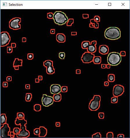 Abb. 3: Corvo identifiziert automatisch alle im Bild vorhandenen Organoide (Organoide mit rotem Rand). Der Benutzer hat dann die Möglichkeit, diejenigen auszuwählen, die für die Analyse von besonderem Interesse sind (der Rand der ausgewählten Organoide wird grün). (Bild: FU Bozen)