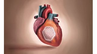 Das Herzpflaster wird aus induzierten pluripotenten Stammzellen gewonnenen Herzmuskel- und Bindegewebszellen in einem Kollagen-Hydrogel hergestellt. (Bild: umg/eva meyer-besting)