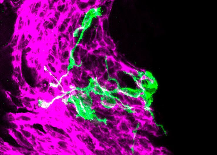 The researchers tracked the development of stem cells using so-called confetti reporters. (Helmholtz Zentrum München)