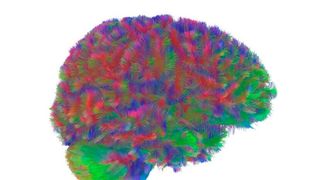 A representative MRI tractography image of the first era of the human brain. This image is representative of the general pattern seen across the brains in the study during the first era of neural wiring, between the ages of zero and nine.  (Source: Dr Alexa Mousley/ University of Cambridge)