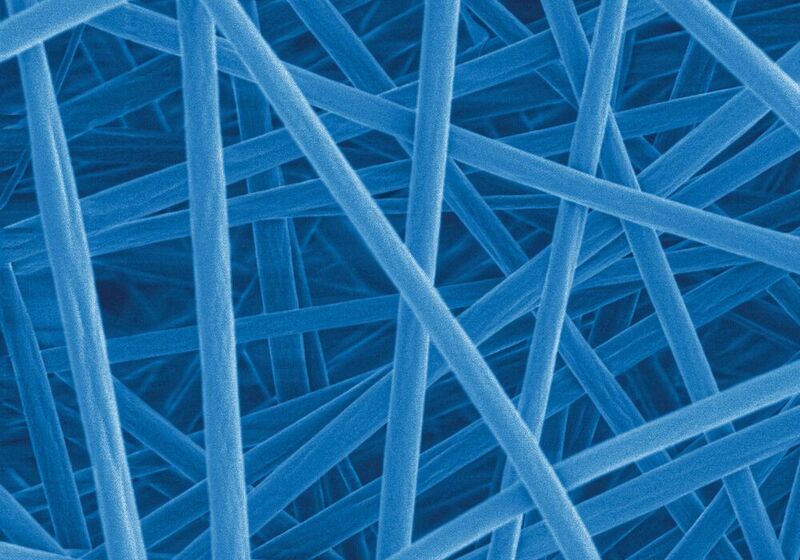 Diese 6.000-fach vergrößerten Nanofasern aus einem Polymergemisch setzen ein antimikrobielles Mittel frei, wenn es ihnen zu warm wird (kolorierte Rasterelektronenmikroskopie). (Empa)