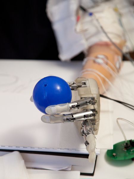 Greiftest: künstliche Hand mit blauem Plastikball (LifeHand 2/Patrizia Tocci)