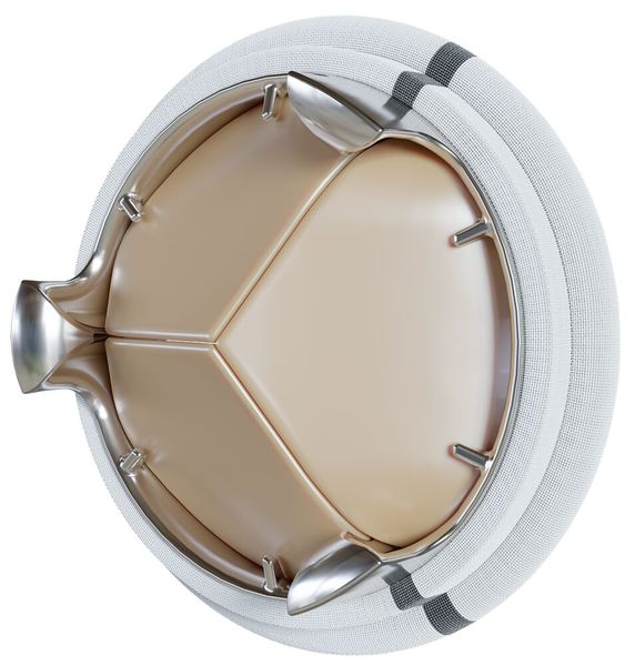 Aorte artificielle avec valves fermées pour le médical chez MPS Micro Precision Systems. (Source : MPS Micro Precision Systems)