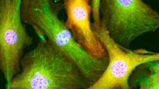 Göttinger Forscher entwickelten eine neue Methode, mit der die im Bindegewebe der Niere verborgenen Fibroblasten (grün) gezielt von krankheitsverursachenden epigenetischen Veränderungen (orange) gesäubert werden können. (umg)